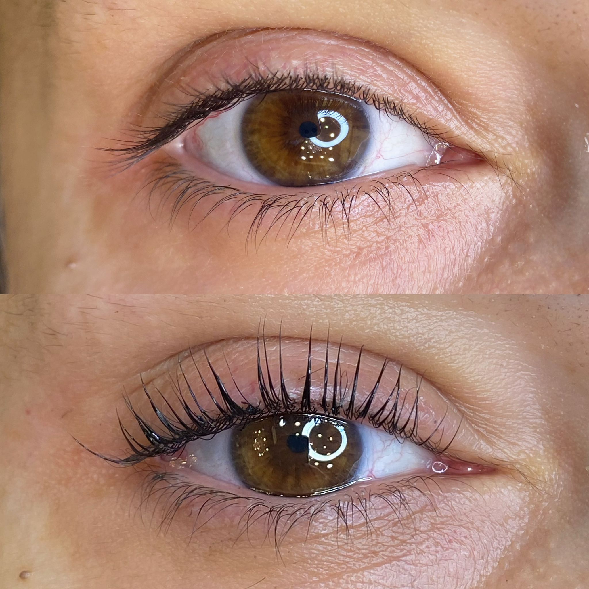 Saç Ekimi Sonuçları